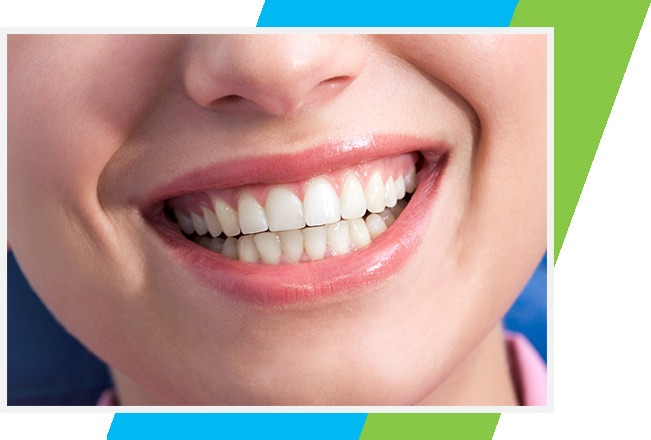 Teeth Whitening West Airdrie Dental | General & Family Dentist | West Airdrie