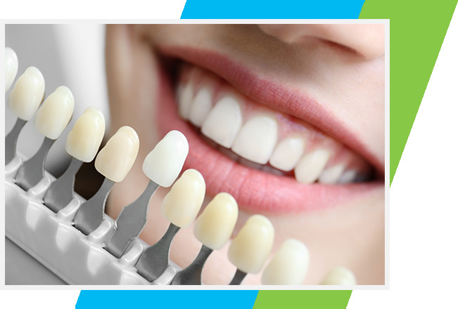 Porcelain Veneers West Airdrie Dental | General & Family Dentist | West Airdrie